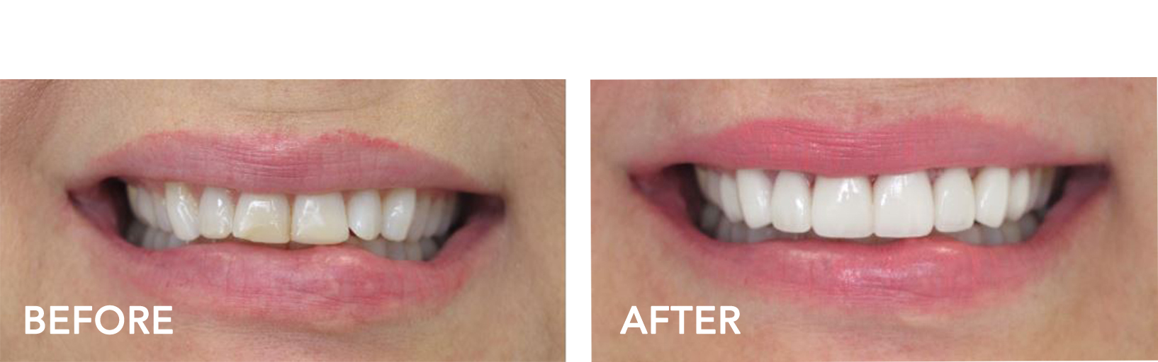 Dentist in Gulfport MS | Pure Smiles Dental | Smile Gallery